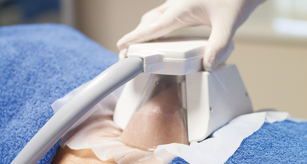 How Fat Freezing and HIFU Work Together? 2 Multiple Areas in One Session HIFU and Fat Freezing Littlehampton