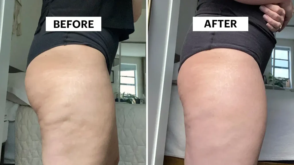 Do Toning Exercise Littlehampton Really Tackle Cellulite?